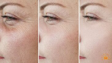 trattamento antirughe